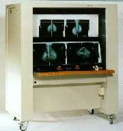Mammoscope MS 604 