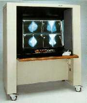 Mammoscope MS 800