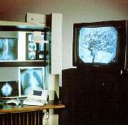 RADX-View
